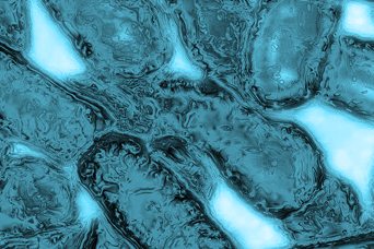 Legionella Bacteria