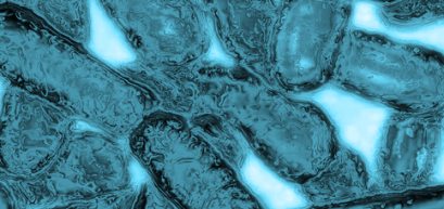 Legionella Bacteria